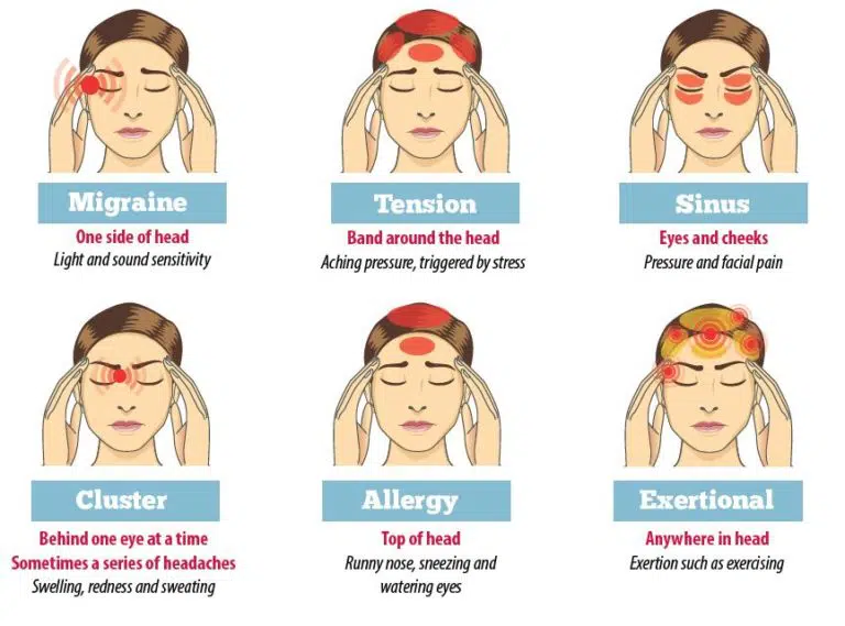 Migraine of spanningshoofdpijn