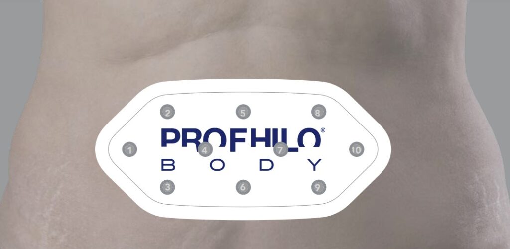 YourFACE Clinics Profhilo Body - Buik